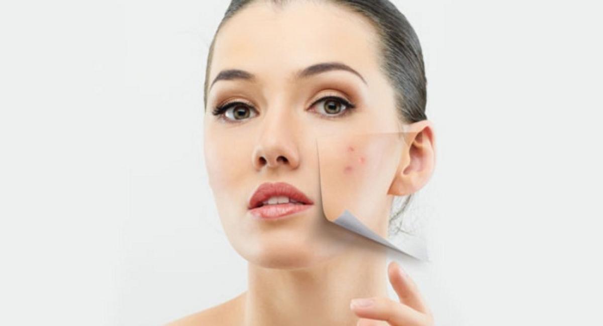 New vaccine to offer treatment for acne